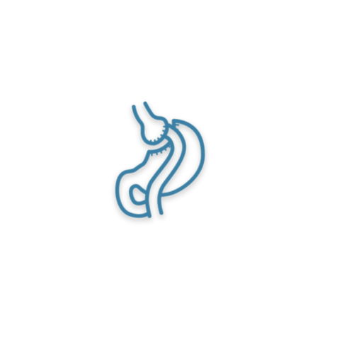 Roux-en-Y Gastric Bypass