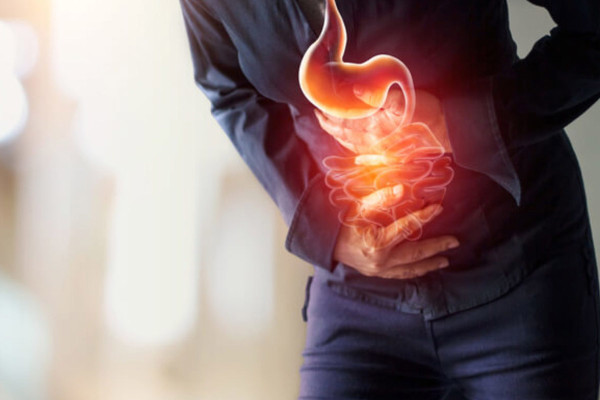 Reflux and Hiatus Hernia